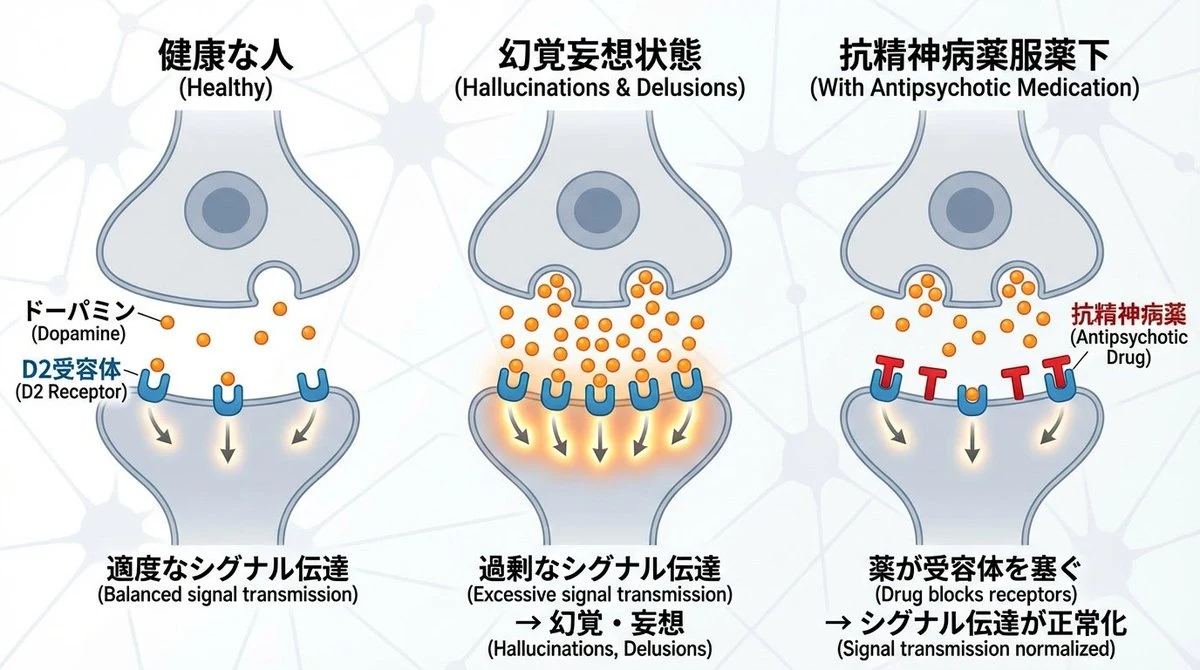 dopamine synapse and schizophrenia mechanism infographic